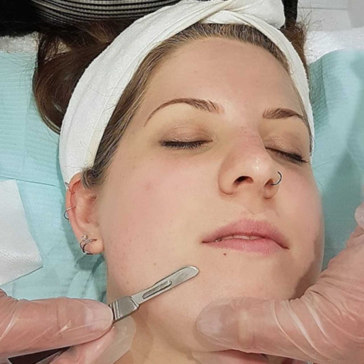woman getting a dermaplaning facial by a professional